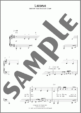Lazarus(David Bowie) 楽譜 ピアノ（ソロ） ダウンロード